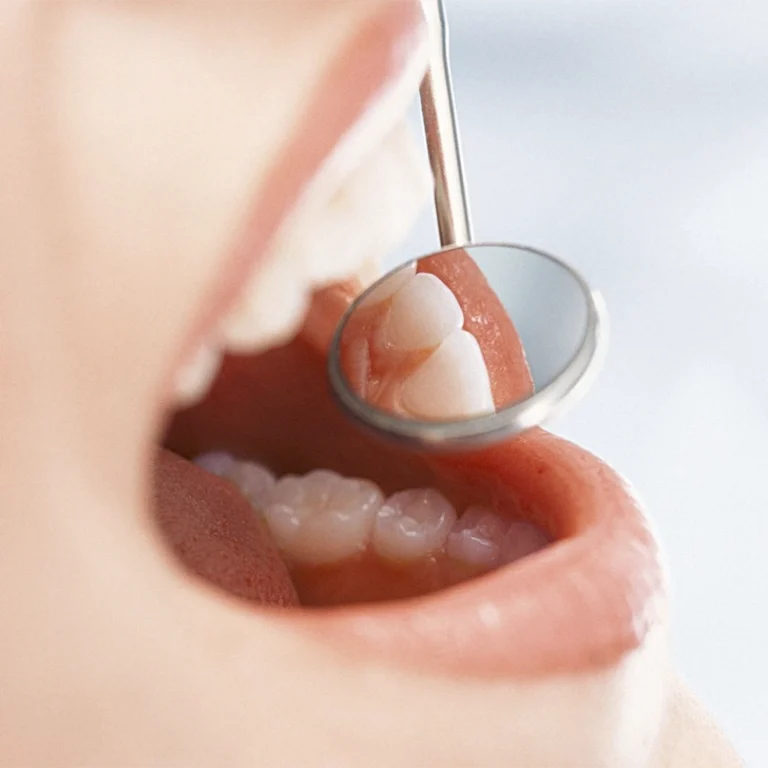 algemene-controle-preventieve-tandheelkunde